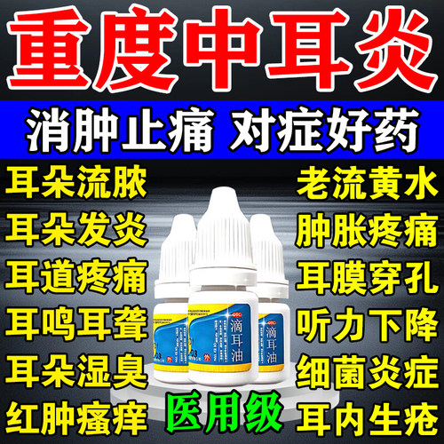 中耳炎专用特疼效药可除耳根滴耳液耳朵消炎耳朵痒流脓流水滴耳油