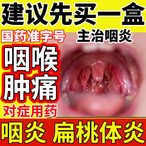 治嗓子疼咽喉炎肿痛喉咙发炎消炎特有新效期药扁桃体专用冬凌草片