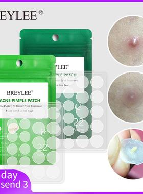 Acne Pimple Patch Stickers Acne Treatment Pimple Remover To