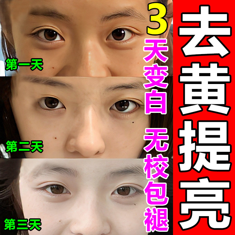 去黄气提亮肤色美白脸色暗黄改善暗沉乳液补水保湿抗氧化淡斑精华