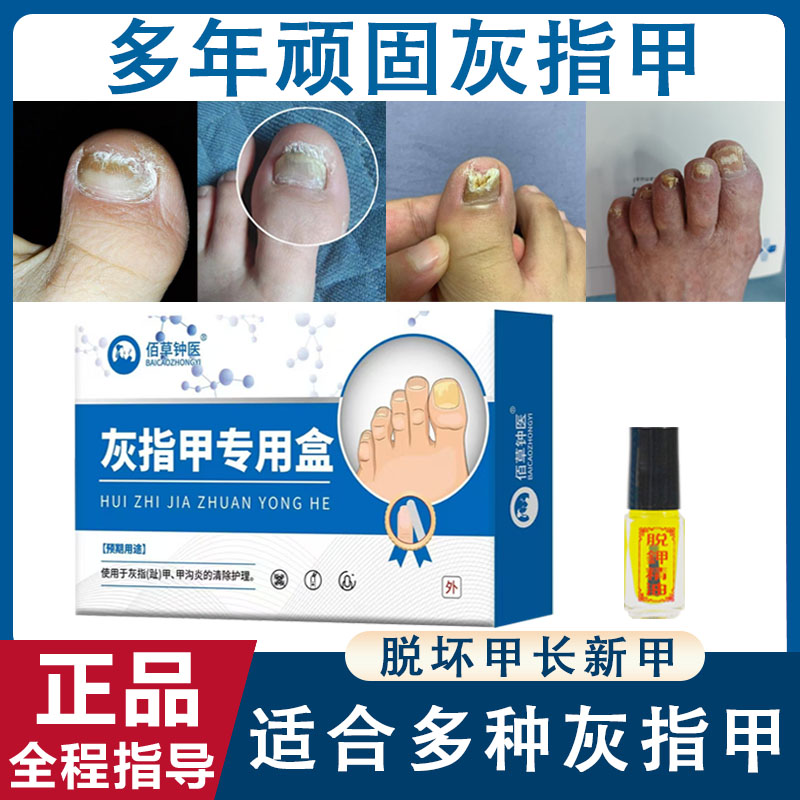 灰指甲专用抑菌脱甲液灰趾指甲变厚发黄快速无痛脱甲精油