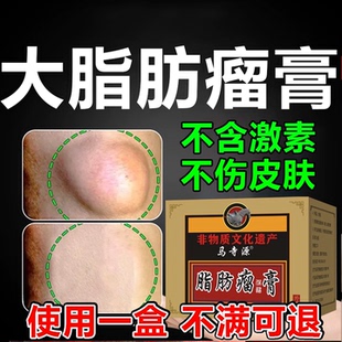 皮下单发性脂肪瘤多发性脂肪瘤消瘤膏神器鼓包硬块肿痛去除药膏