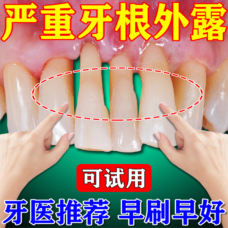极速【比换牙还快】牙银萎缩修复再生牙齿松M动牙根外露固齿牙膏J