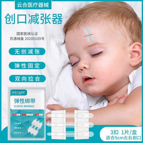 弘生医用减张器免缝合伤口缝合器