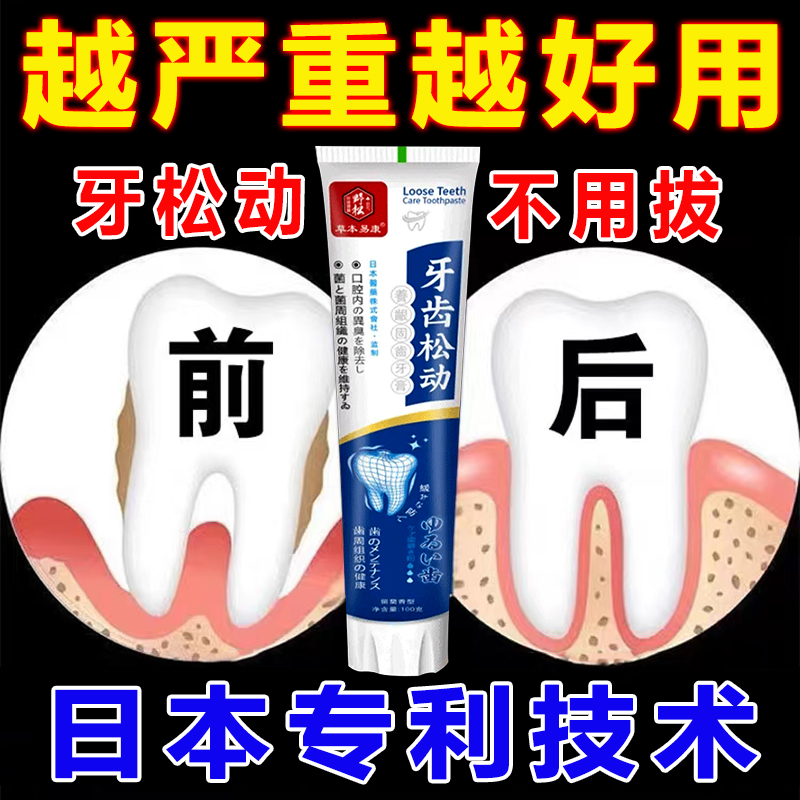 极速牙齿松动萎缩牙痛敏感牙龈肿痛出F血牙间隙大牙晃动固齿护理