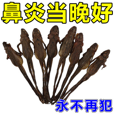 儿童鼻炎鼻甲肥大专用药贴