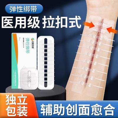 医用皮肤伤口免缝减张贴刨剖腹产疤痕减张器甲状腺术后拉链创口贴