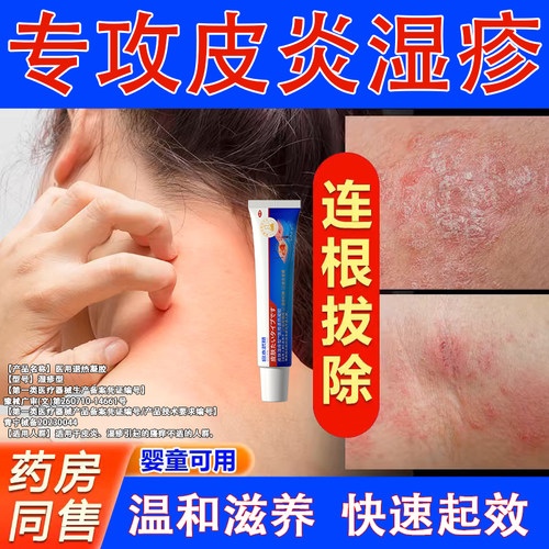 宫本武藏皮肤湿痒皮炎湿疹水泡止痒大腿根肛门私处潮湿瘙痒药膏TY
