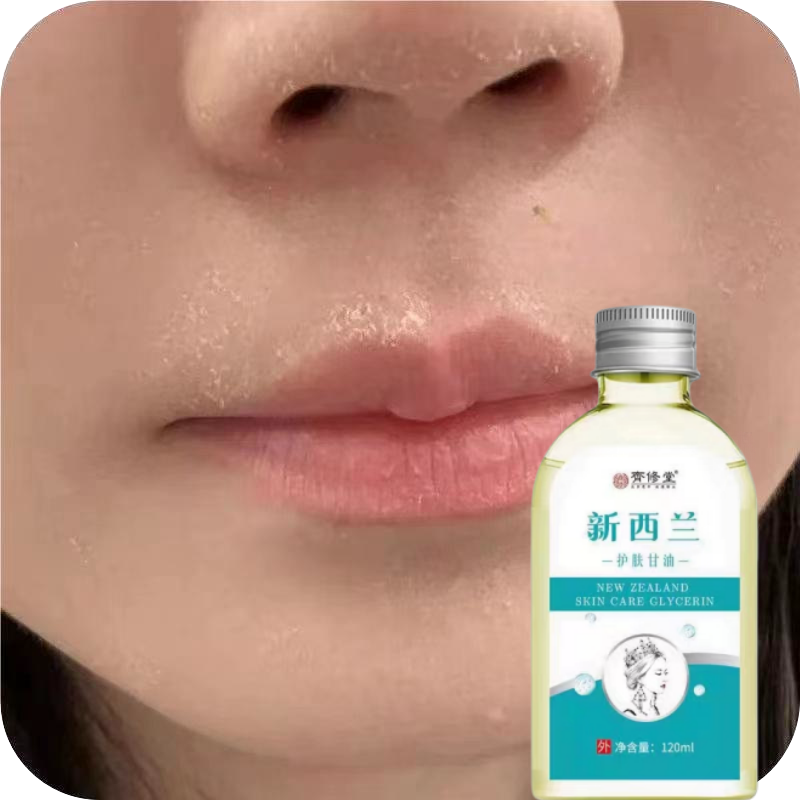 脸上起皮掉皮干皮脸上起干皮脸上干燥起皮脸干身体皮屑起皮干皮