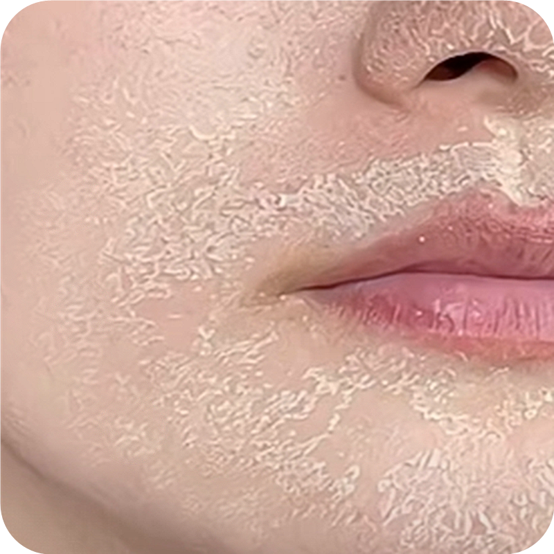 面部干燥起皮脸干起皮掉皮干皮脸干燥起皮痒脸上起皮干燥脸干痒