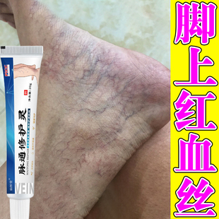 腿上有红血丝凝胶修复毛细血管扩张腿部青筋凸起软膏