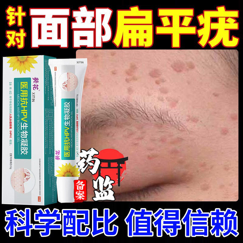 脸上扁平疣去疣瘊凸起小肉粒面部脸上去疣肉粒疙瘩去除膏一抹灵UU