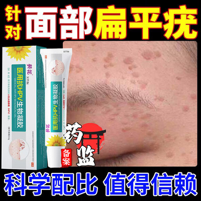 脸上扁平疣去疣瘊凸起小肉粒面部脸上去疣肉粒疙瘩去除膏一抹灵MR