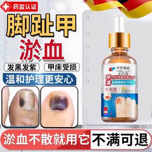 甲沟炎脚趾甲被砸指甲被夹甲床受损甲下淤血发紫发黑真菌感染ZT