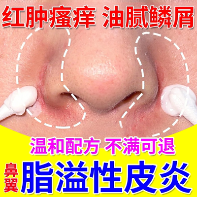鼻翼脂溢性皮炎面部面霜软膏鼻子两侧发红马拉色菌干燥起皮脱皮UU