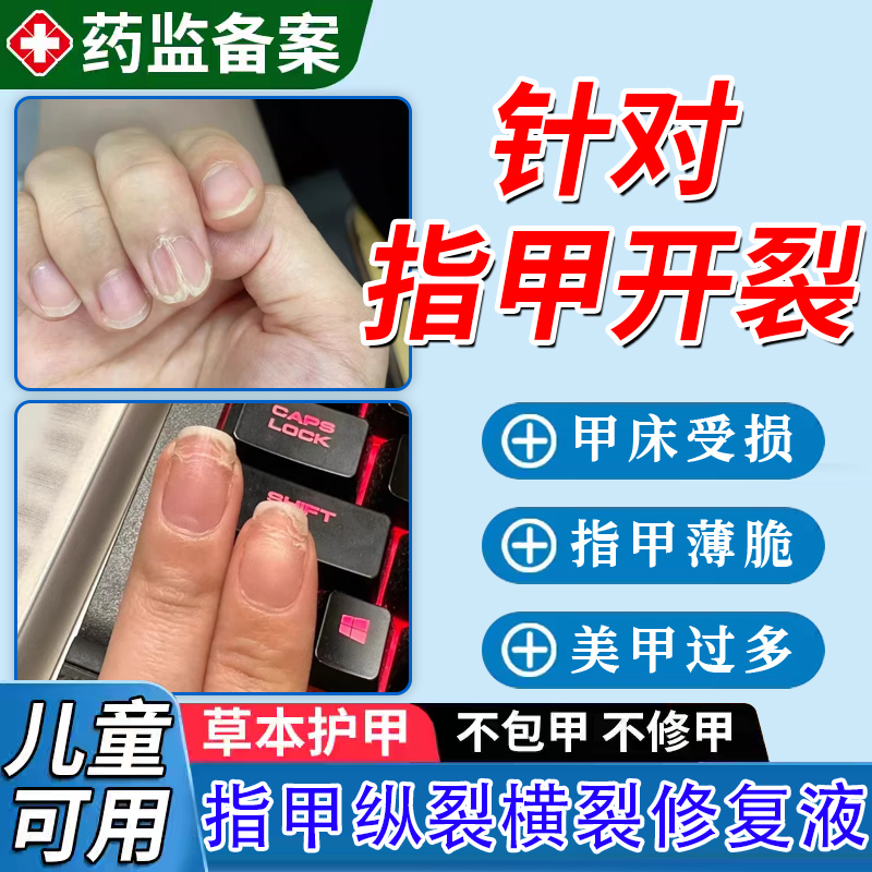 手脚指甲开裂修复液中间断裂纵裂药凹凸不平薄软受损再生养甲床TT
