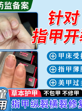 手脚指甲开裂修复液中间断裂纵裂药凹凸不平薄软受损再生养甲床TT