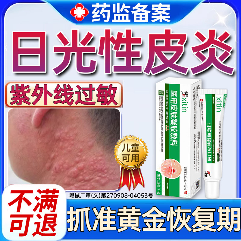日光性皮炎特效紫外线过敏修复霜专用膏医太阳晒伤皮肤发痒神经PP