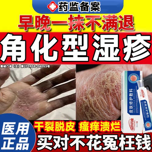 角化型湿疹手足癣膏药手部指脚脱皮干裂增厚感染干燥粗糙修复霜LT