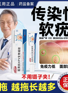 传染性软疣药膏儿童病毒水子软尤肉粒药膏瘊可搭配医用镊子夹子LT