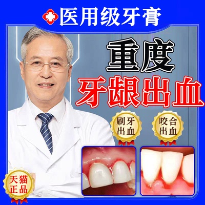 云南白药牙膏牙周炎牙龈出血专用正品护龈止痛双效抗敏官方旗舰gx