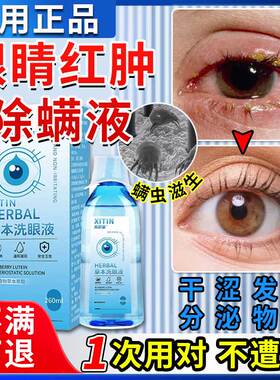 除螨洗眼液眼睛有螨虫眼红干痒痛医用清洁消炎去异物止痒眼药水ZT