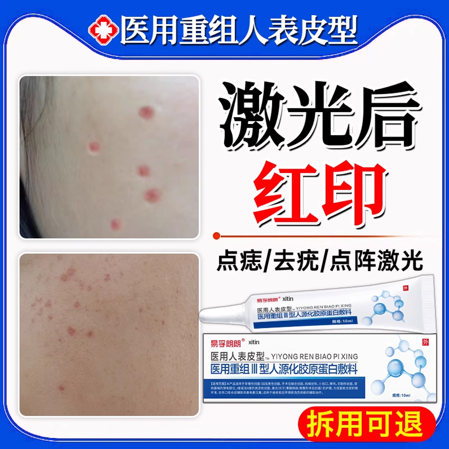 【医用级】激光术后红印修复膏