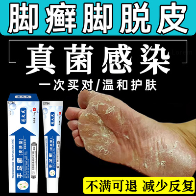 足癣脚癣一次净官方旗舰店脚脱皮干裂真菌感染药膏贵州神奇止痒UU