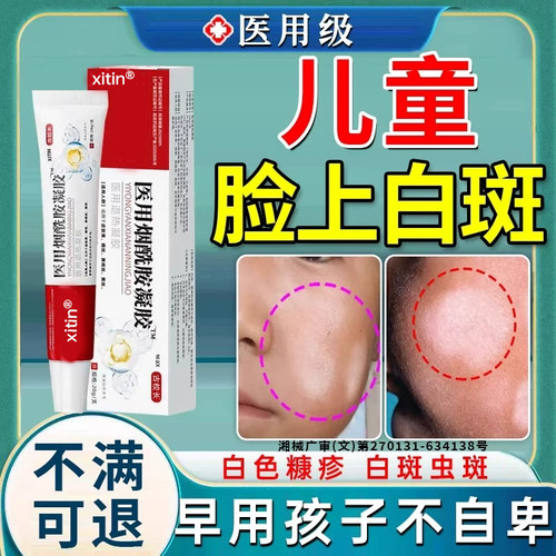 白色糠疹药膏儿童脸上长白斑维生I素e乳膏儿童医烟酰胺皮肤用UU