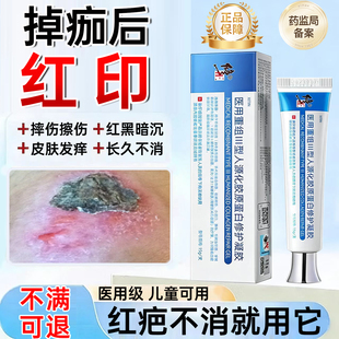 摔伤擦伤结痂掉痂后留红印疤痕修复凝胶去红黑印淡化止痒除疤膏WY