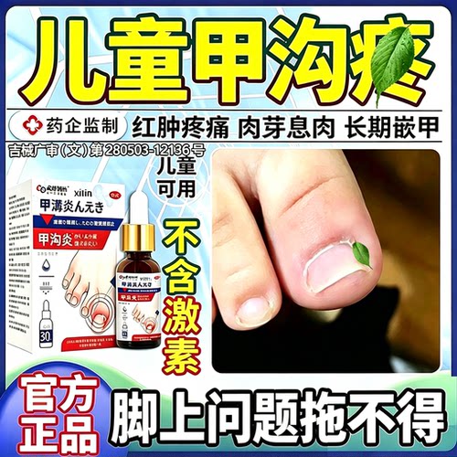 儿童甲沟炎治疗膏甲沟治疗矫正婴儿嵌甲脚趾甲增厚变黄往里长FY