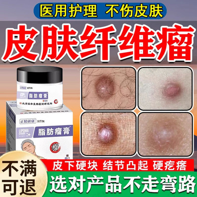 【医师推荐】皮肤纤维瘤硬块去除