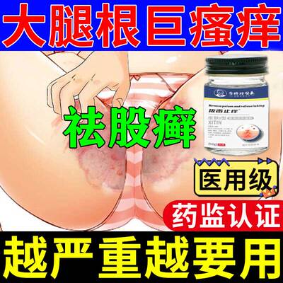 股藓大腿内侧皮肤瘙痒