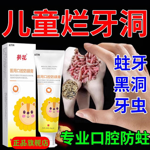 葵花儿童牙膏6到12岁含氟换牙期防蛀固齿牙膏防蛀牙龋齿修复HM