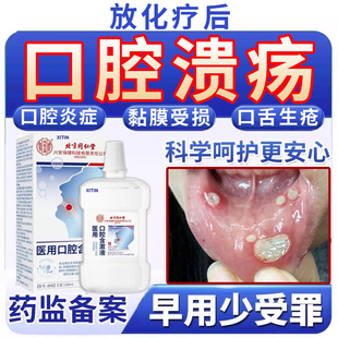 放疗化疗后用口腔溃疡口腔黏膜炎漱口水口舌干生疮疼痛人工唾液UU