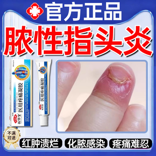 脓性指头炎手指真菌感染甲内红肿疼溃烂甲沟炎边缘流脓消肿化脓WY