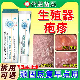 男士生殖器疱疹泡克星阴茎真菌感染抗病毒喷雾特效膏立停日本TT
