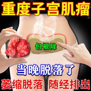 子宫肌瘤中药暖宫贴大姨妈贴宫暖正品调理月经女生宫寒腹痛囊肿ZT