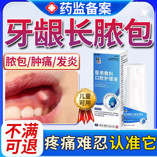 牙龈脓包肿痛消炎专用喷剂牙根发炎上火肿包牙周炎增生息肉出血UU