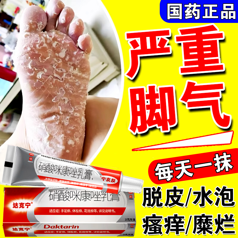 【达克宁】硝酸咪康唑乳膏2%*20g*1支/盒