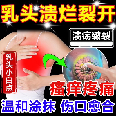 乳头皲裂溃疡疼痛结痂白点泡增生