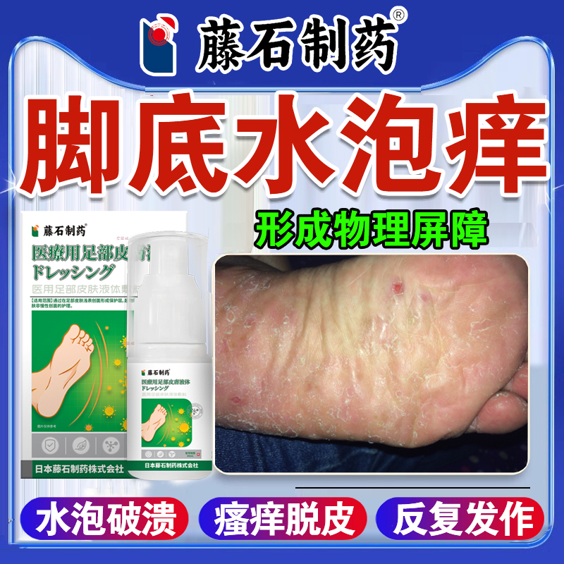 【药监局备案】脚底水泡痒脱皮