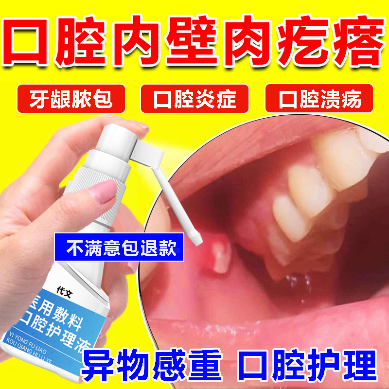 口腔内壁长肉疙瘩腮腺炎导口发炎
