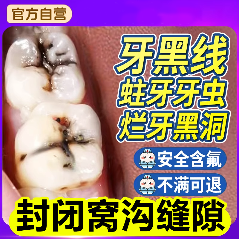 防蛀牙龋齿儿童去黑线专蛀清理牙虫用菌斑牙疼去黑斑医用牙膏wg