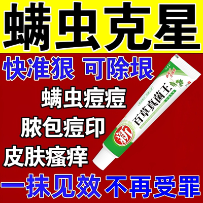 螨虫药膏止痒特效药人用脸上螨虫除螨祛痘后背杀菌药淡化痘印专用