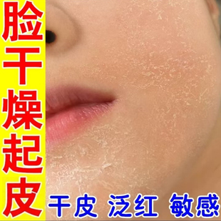 脸部起皮掉皮脸干痒脸上脱皮秋冬发痒全身爆皮掉皮屑涂抹膏药