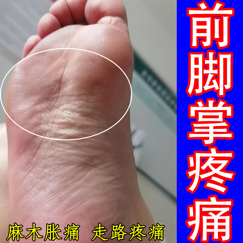 前脚掌疼脚底板疼痛酸胀足底筋膜走路疼脚掌僵硬酸痛胀专用膏