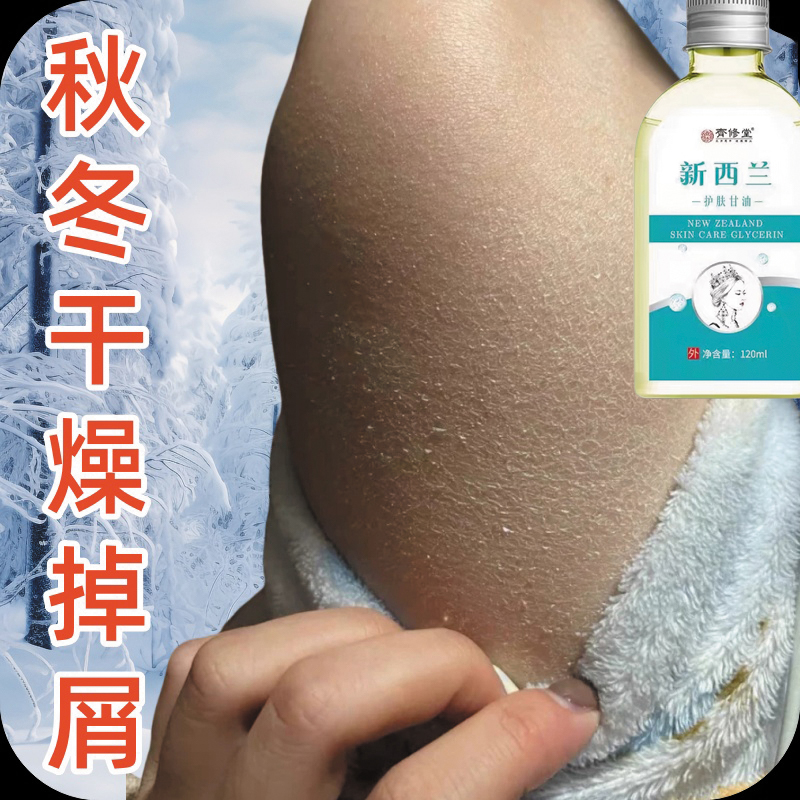 鱼鳞皮全身四肢鱼鳞皮肤鸡皮肤干燥粗糙掉屑干痒腿干痒身体乳液霜