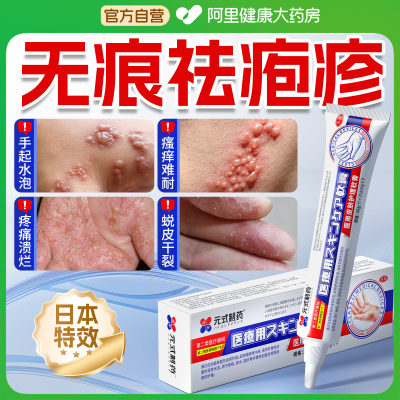 汗疱疹药膏去手上起小水泡汗状疱疹根脱皮杀菌汉状真菌感染止痒药