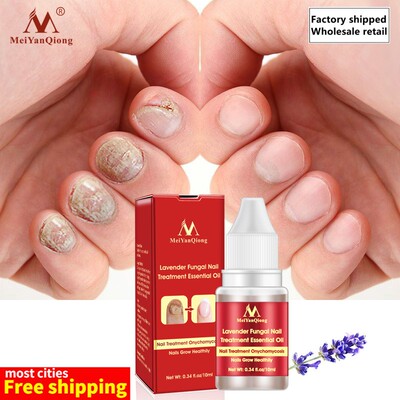 极速Lavecnder Fungal Nail Treatment Essential Oil Promote Na